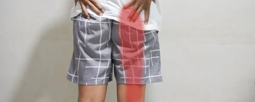 Man experiencing recurring sciatic nerve pain in lower back and leg