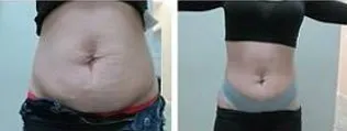 Side-by-side front views of the midsection