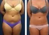 Side-by-side full-length front views of the torso