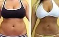 Side-by-side front views of the abdomen and waist