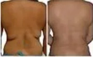 Side-by-side rear views of the waist and lower back