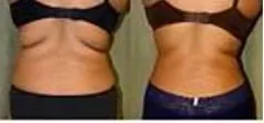 Side-by-side rear views of the waist