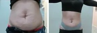 Side-by-side front views of the midsection
